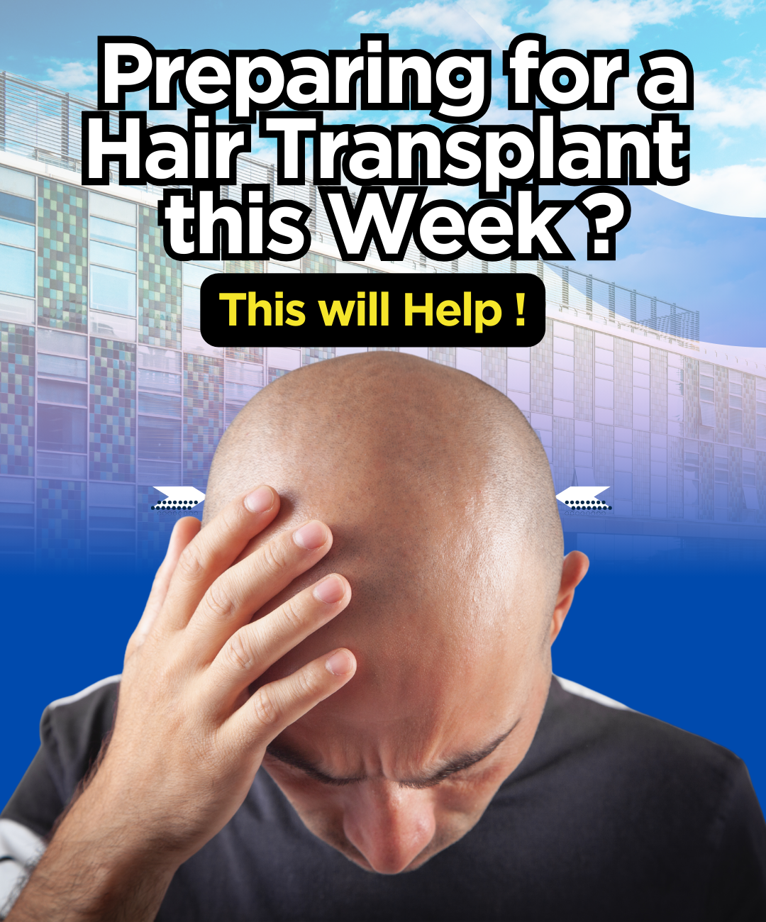 Do this before your Hair Transplant   DOs & Donts