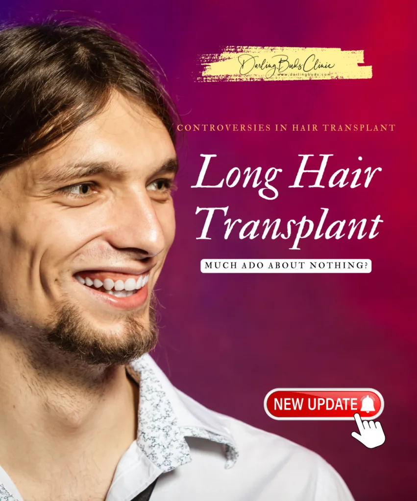 Long Hair Transplant